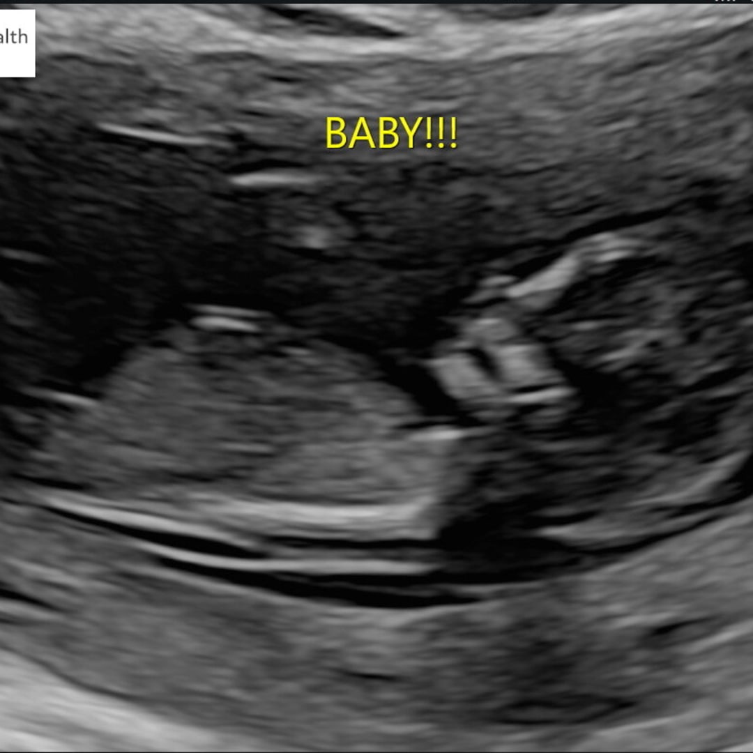 Photo shared by Carmen for their Babylist baby registry.