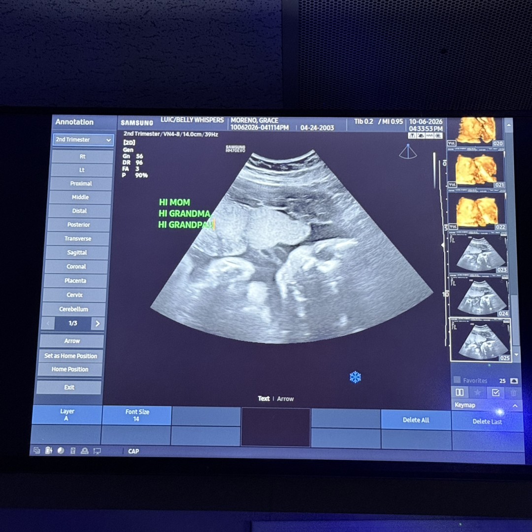 Photo shared by Grace for their Babylist baby registry.