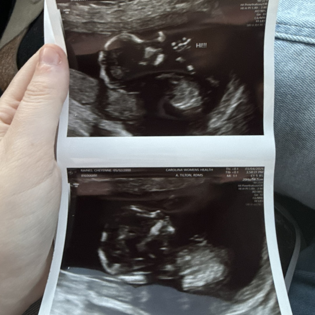 Photo shared by Cheyenne for their Babylist baby registry.