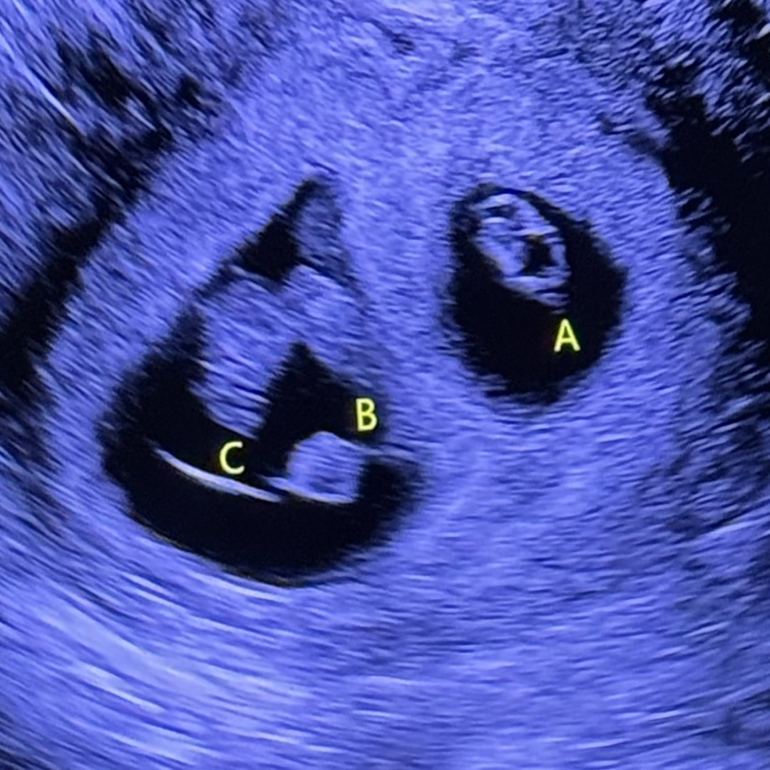 Photo shared by Jannie for their Babylist baby registry.