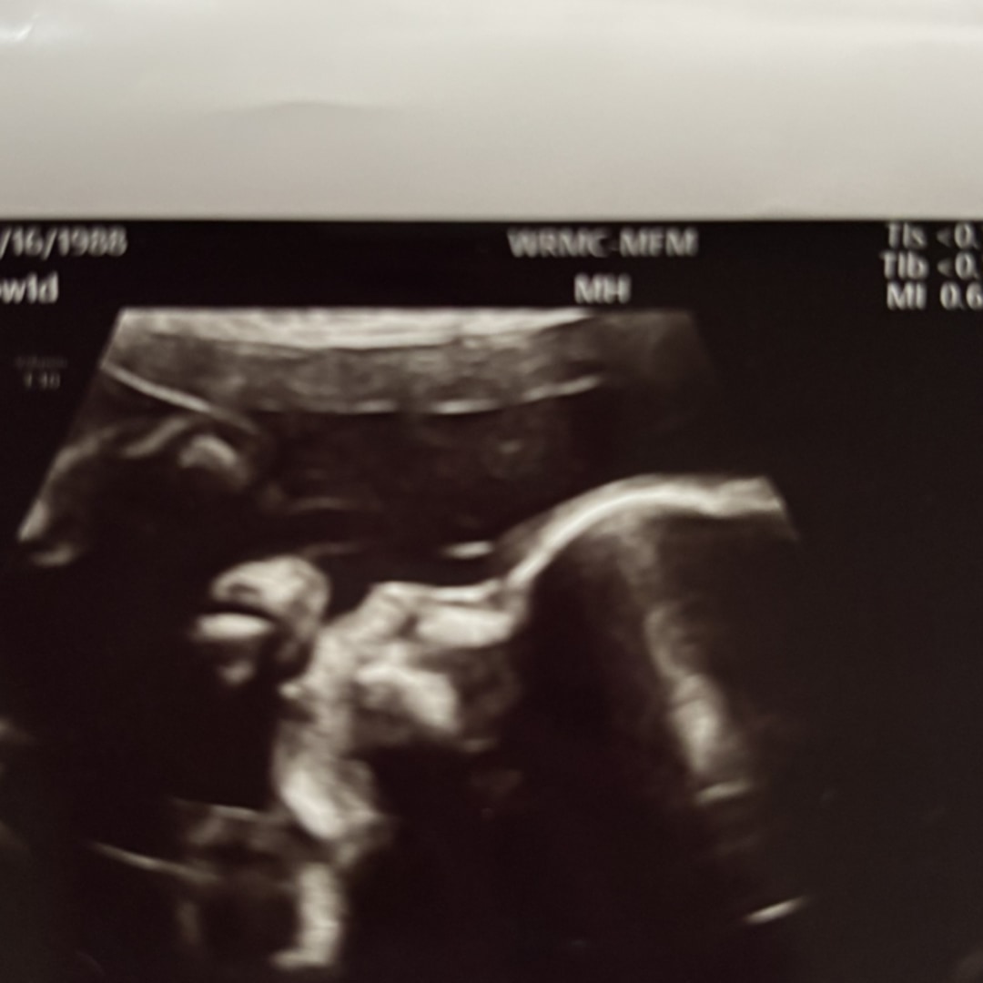Photo shared by Autumn for their Babylist baby registry.