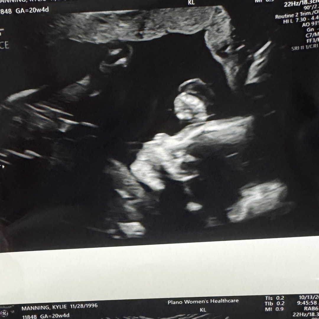 Photo shared by Kylie for their Babylist baby registry.