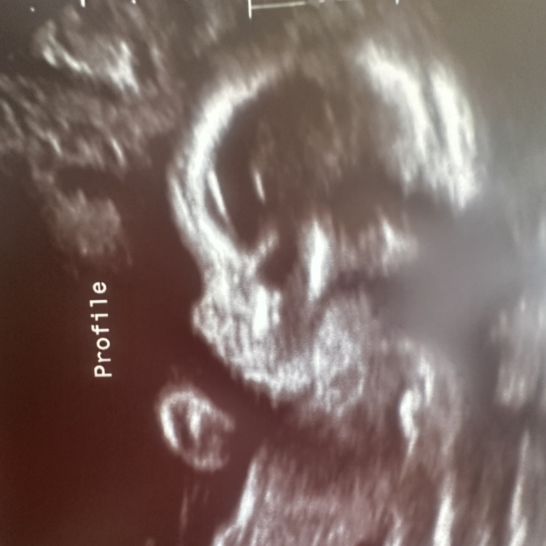 Photo shared by Dylan for their Babylist baby registry.