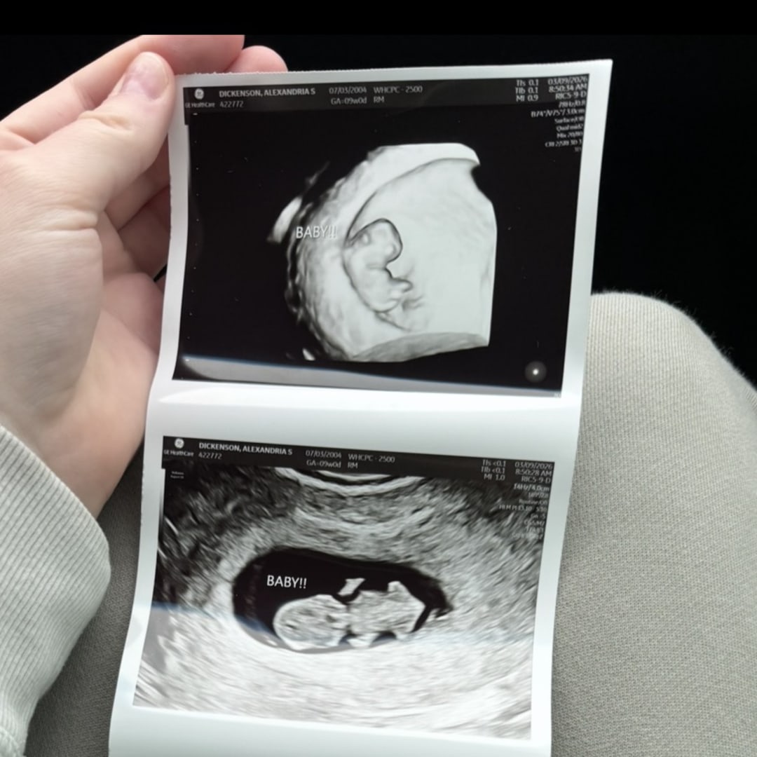 Photo shared by Skye for their Babylist baby registry.