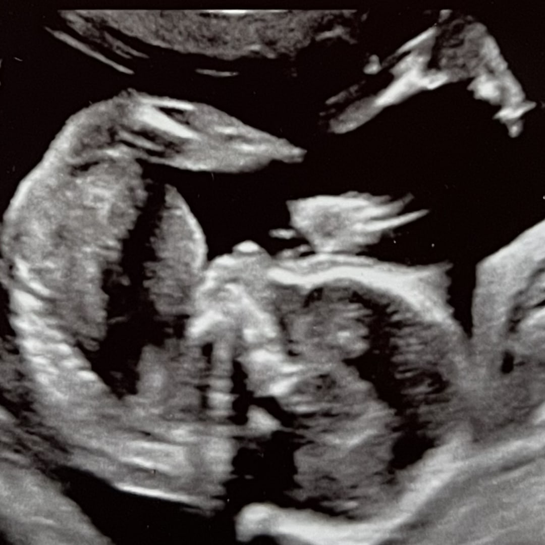 Photo shared by Annabell for their Babylist baby registry.