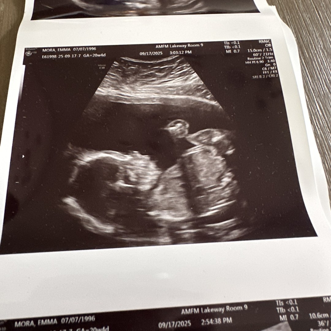 Photo shared by Emma for their Babylist baby registry.