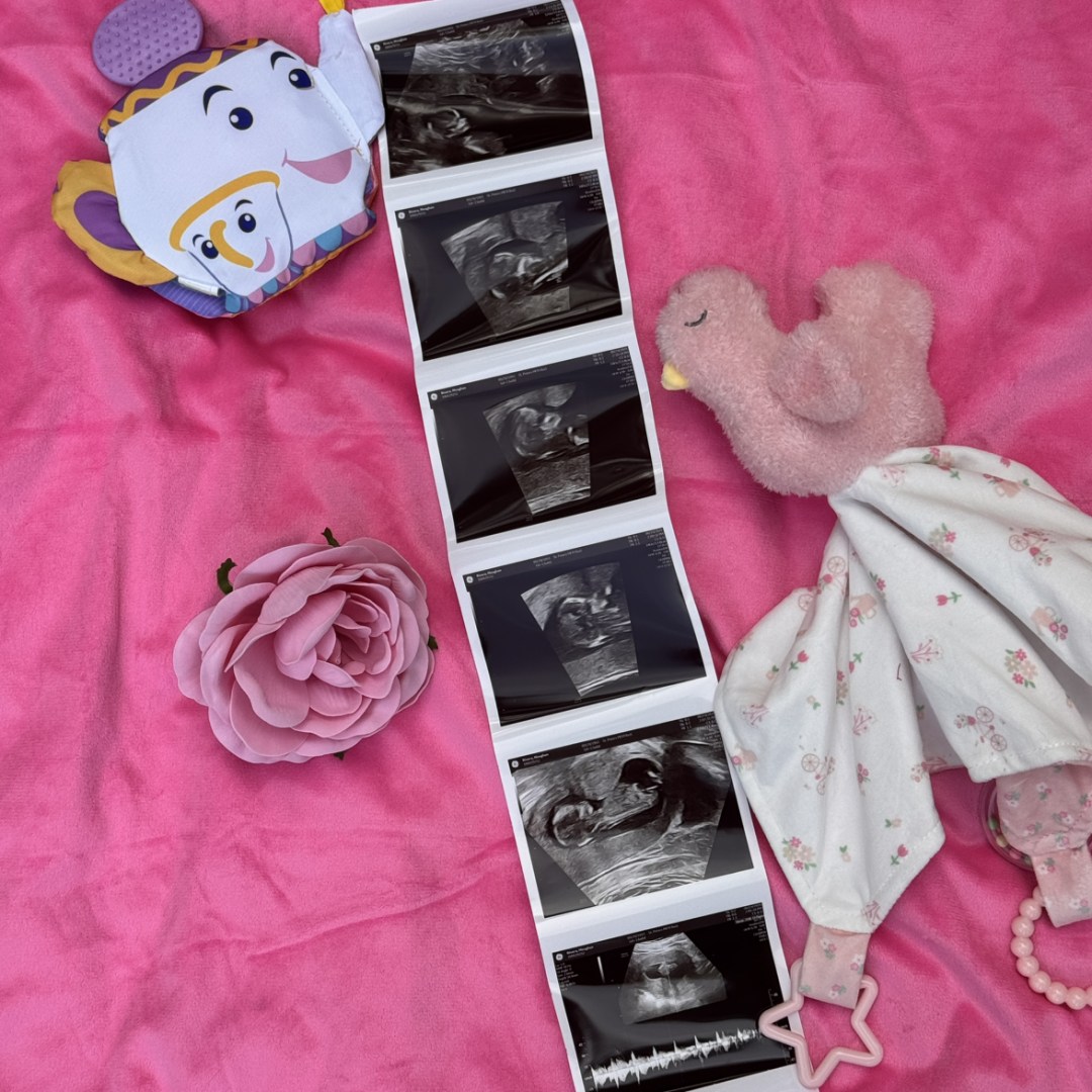 Photo shared by Meaghan for their Babylist baby registry.