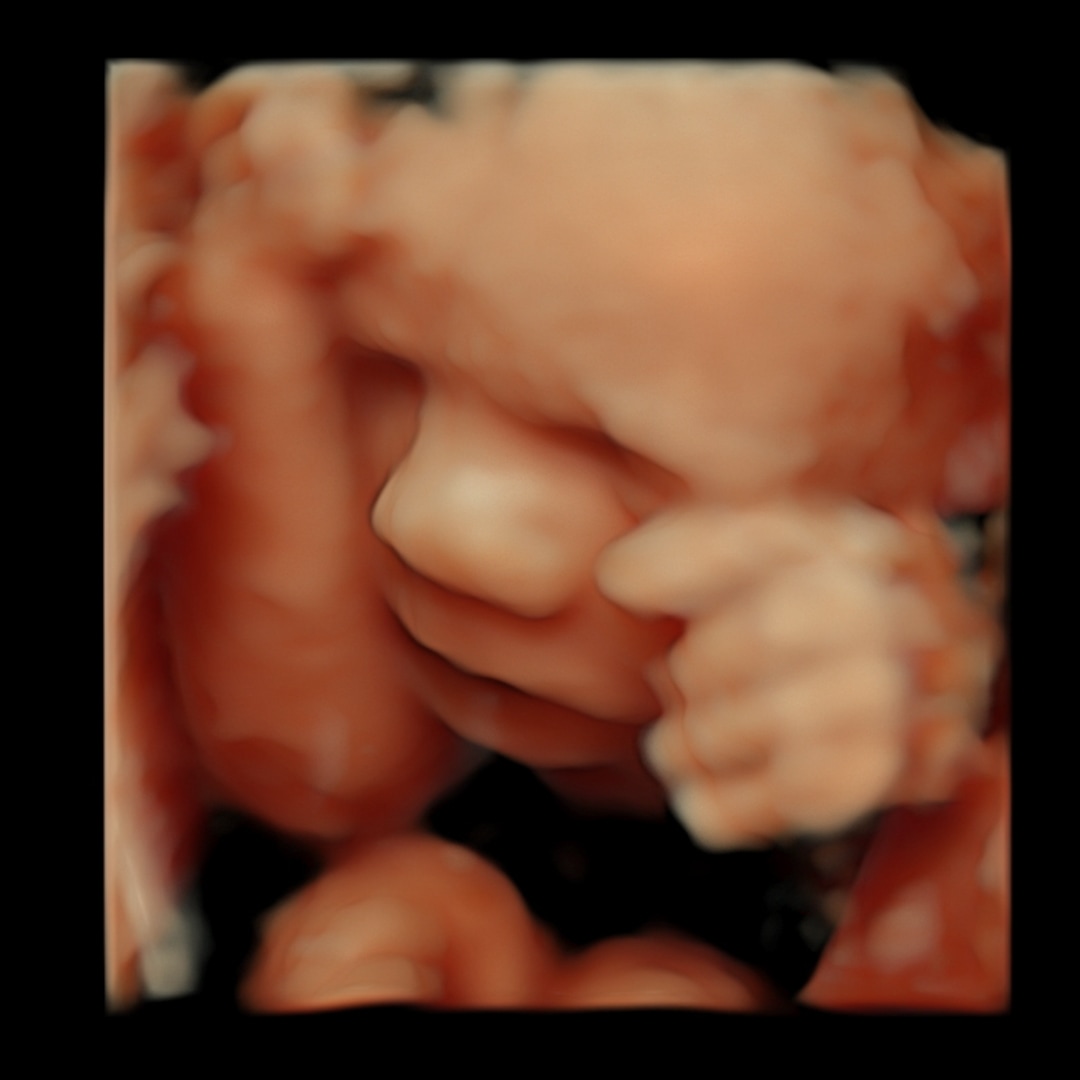 Photo shared by Hannah for their Babylist baby registry.