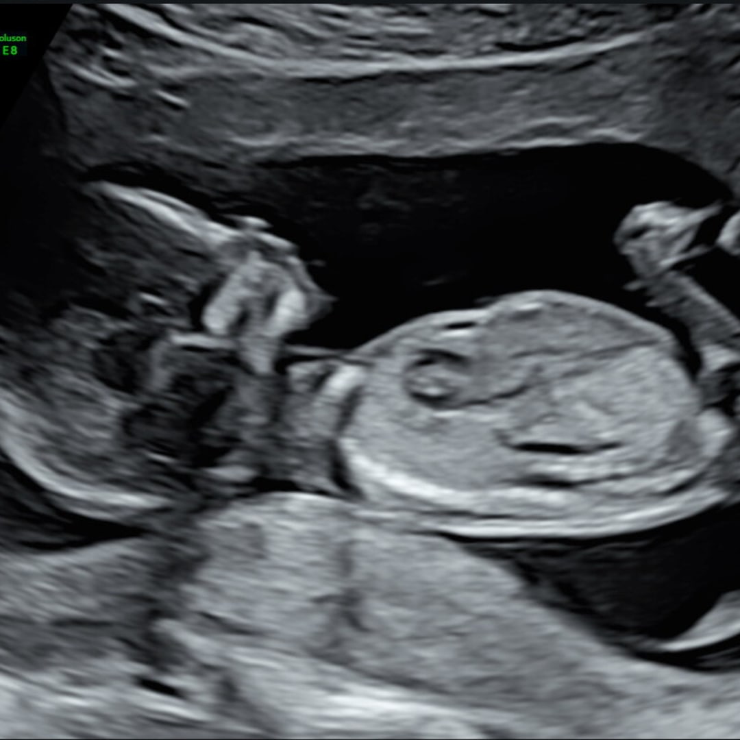 Photo shared by Shane for their Babylist baby registry.