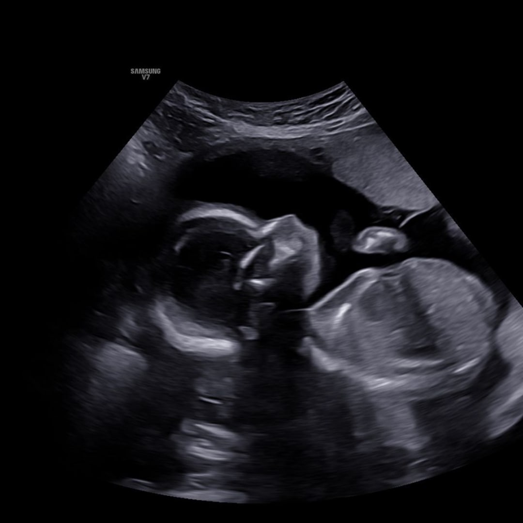 Photo shared by Maddie for their Babylist baby registry.