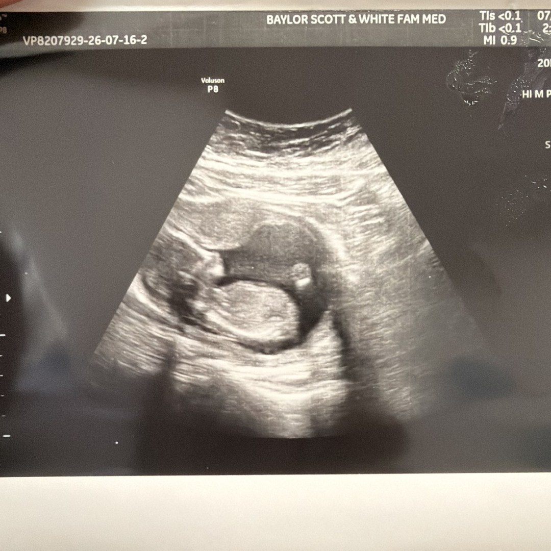 Photo shared by Evelyn for their Babylist baby registry.