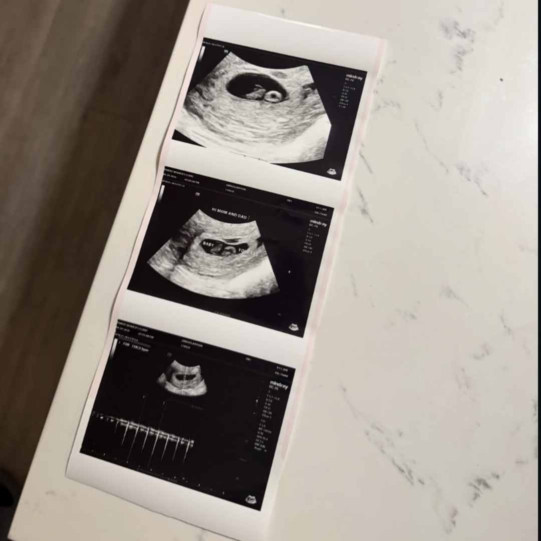 Photo shared by Rayion for their Babylist baby registry.