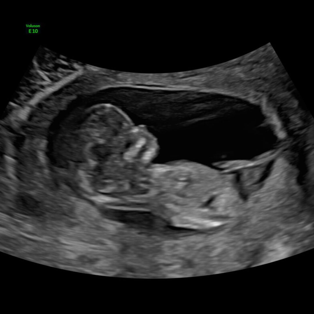 Photo shared by Rachel for their Babylist baby registry.
