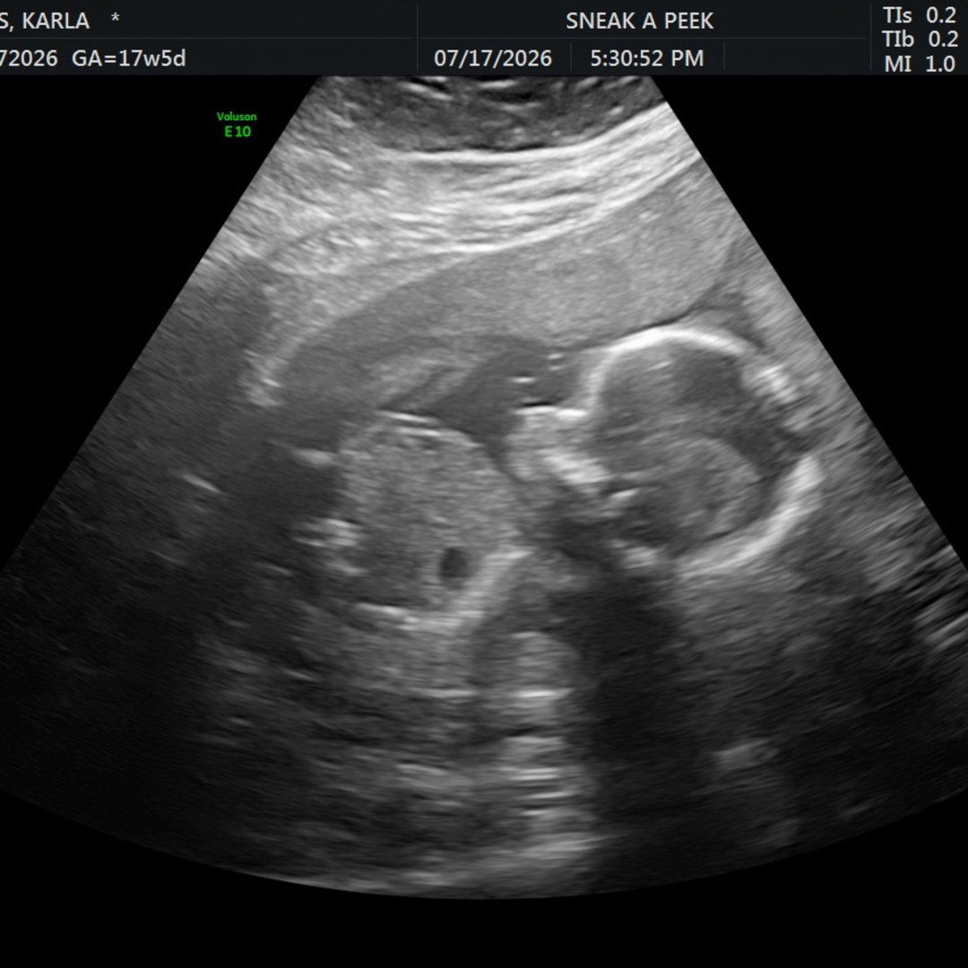 Photo shared by Karla for their Babylist baby registry.