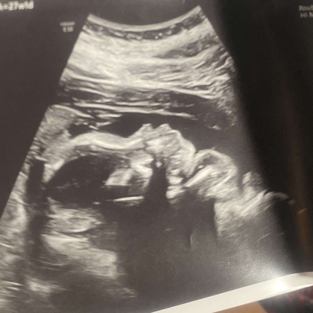 Photo shared by Amia for their Babylist baby registry.