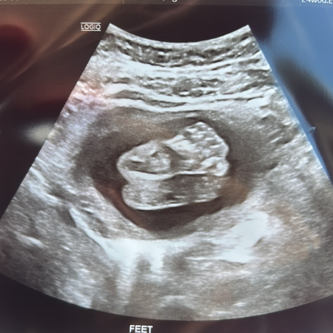 Photo shared by Kemberly for their Babylist baby registry.