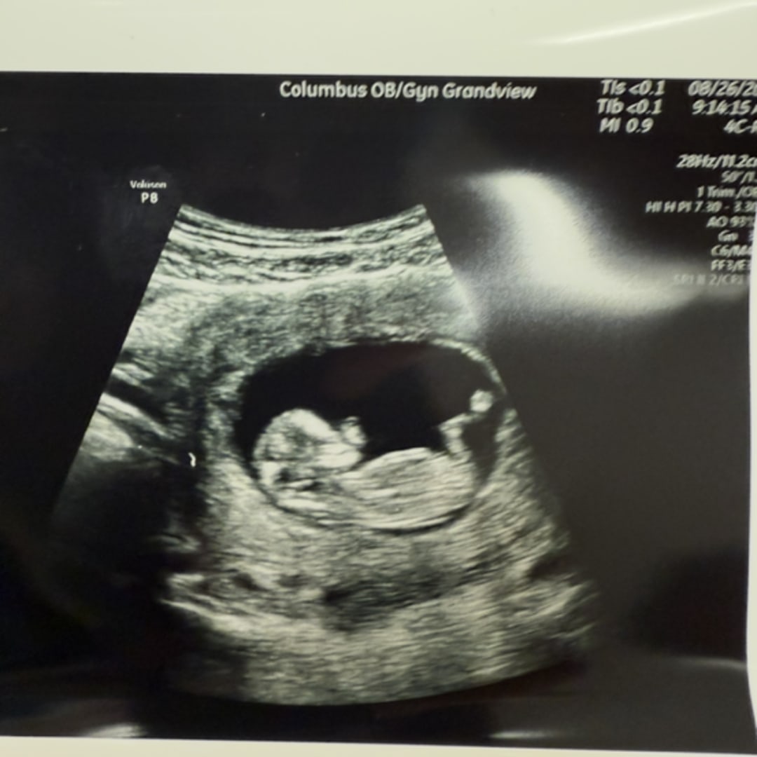 Photo shared by Chelsea for their Babylist baby registry.