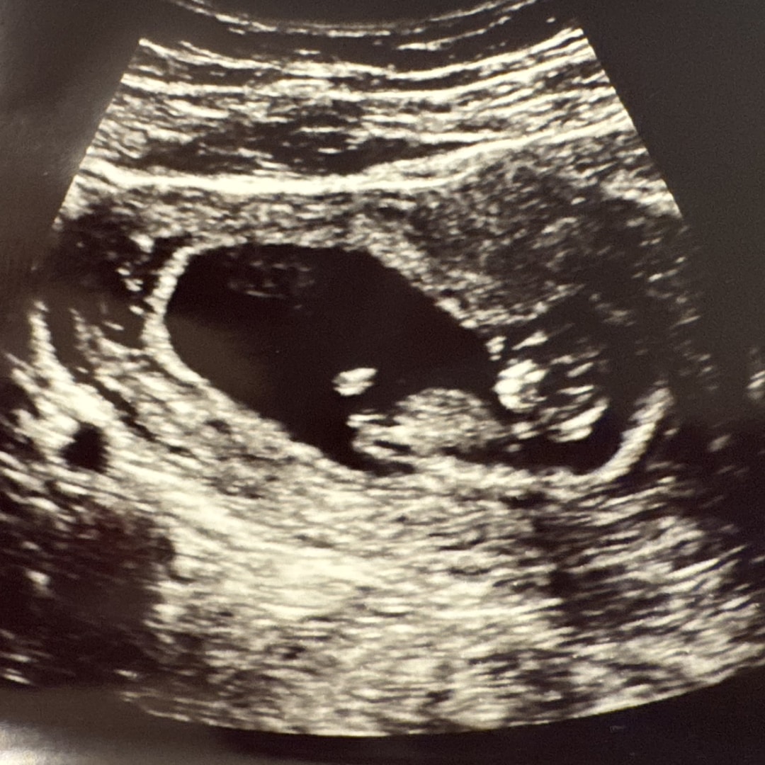 Photo shared by Suzanne for their Babylist baby registry.