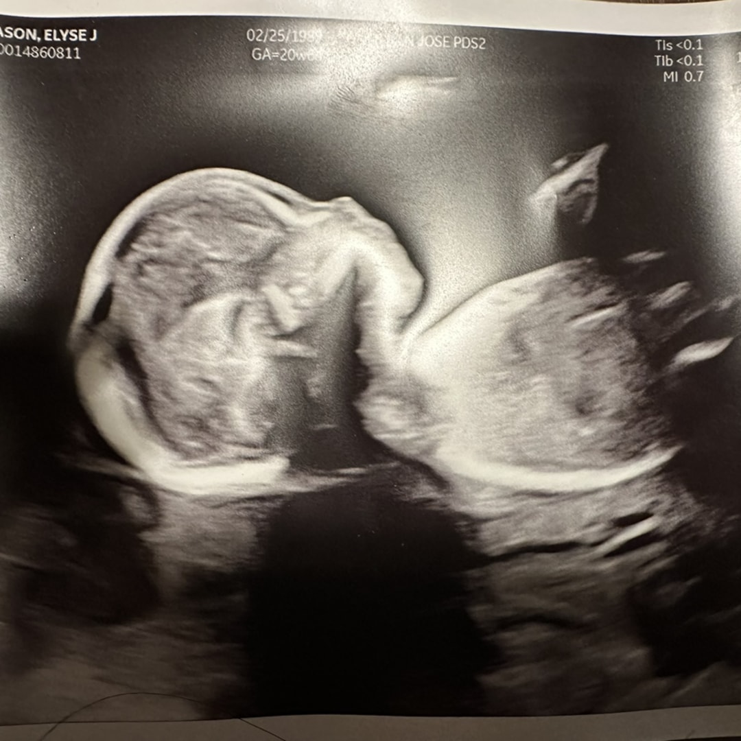 Photo shared by Elyse for their Babylist baby registry.
