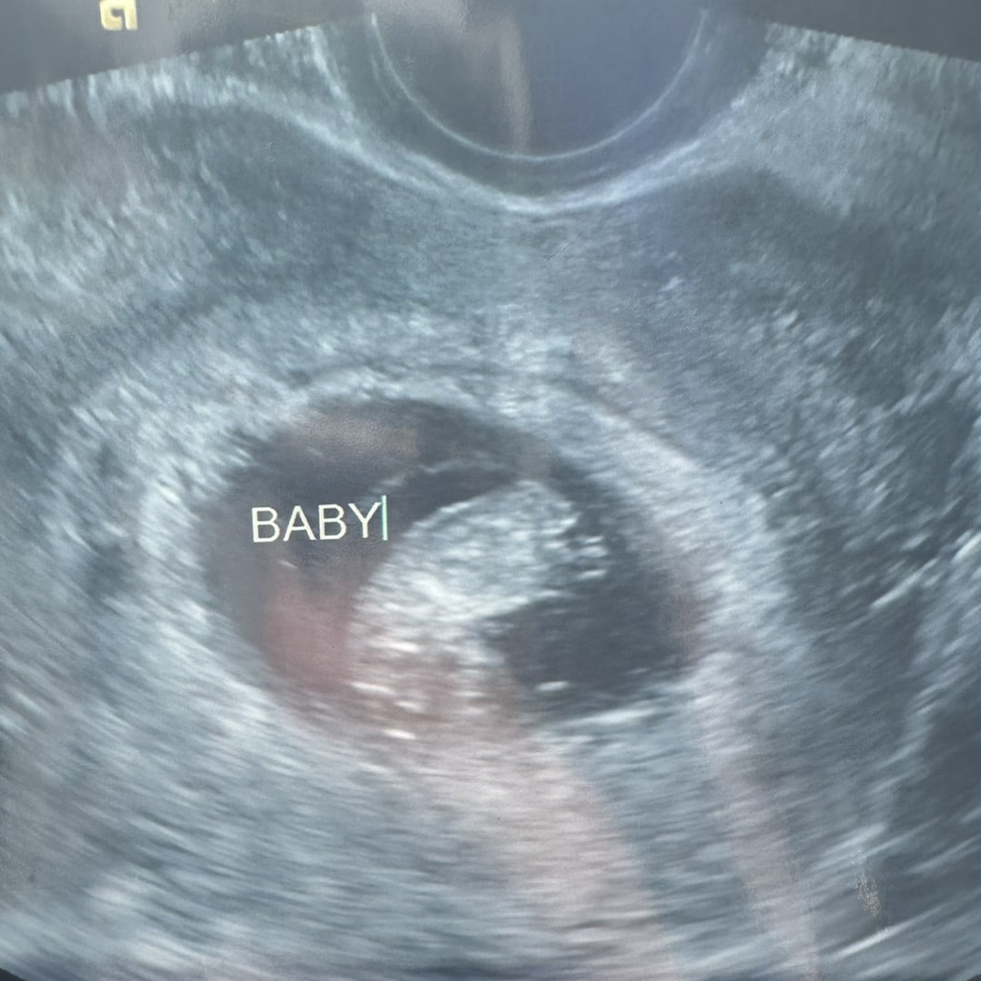 Photo shared by Kadence for their Babylist baby registry.