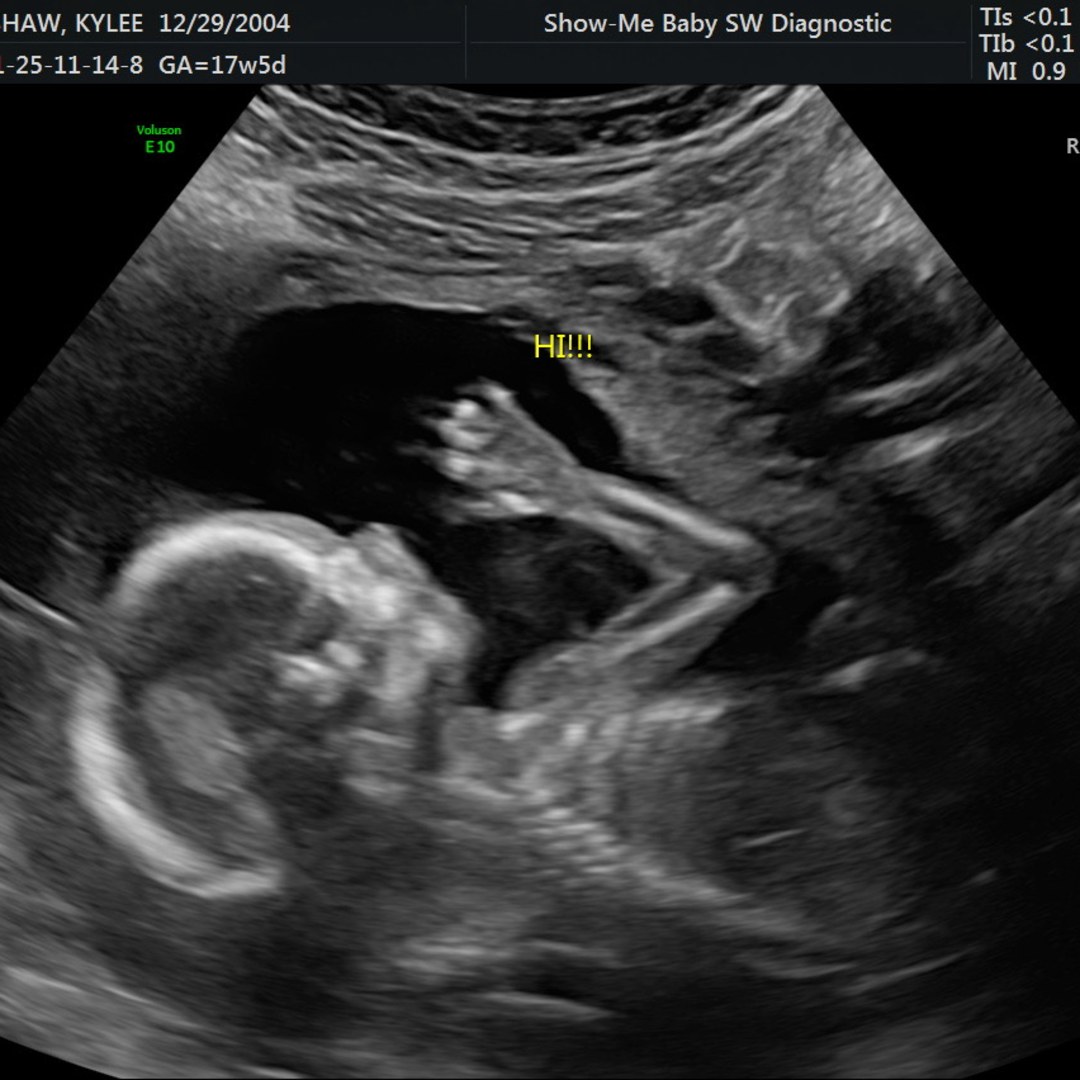 Photo shared by Kylee for their Babylist baby registry.