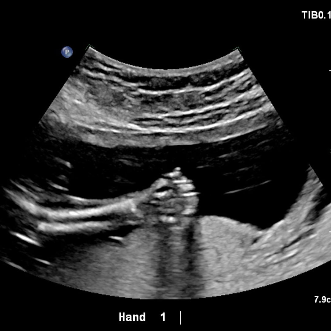 Photo shared by Annika for their Babylist baby registry.