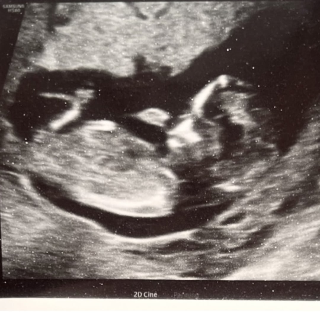 Photo shared by Bianca for their Babylist baby registry.