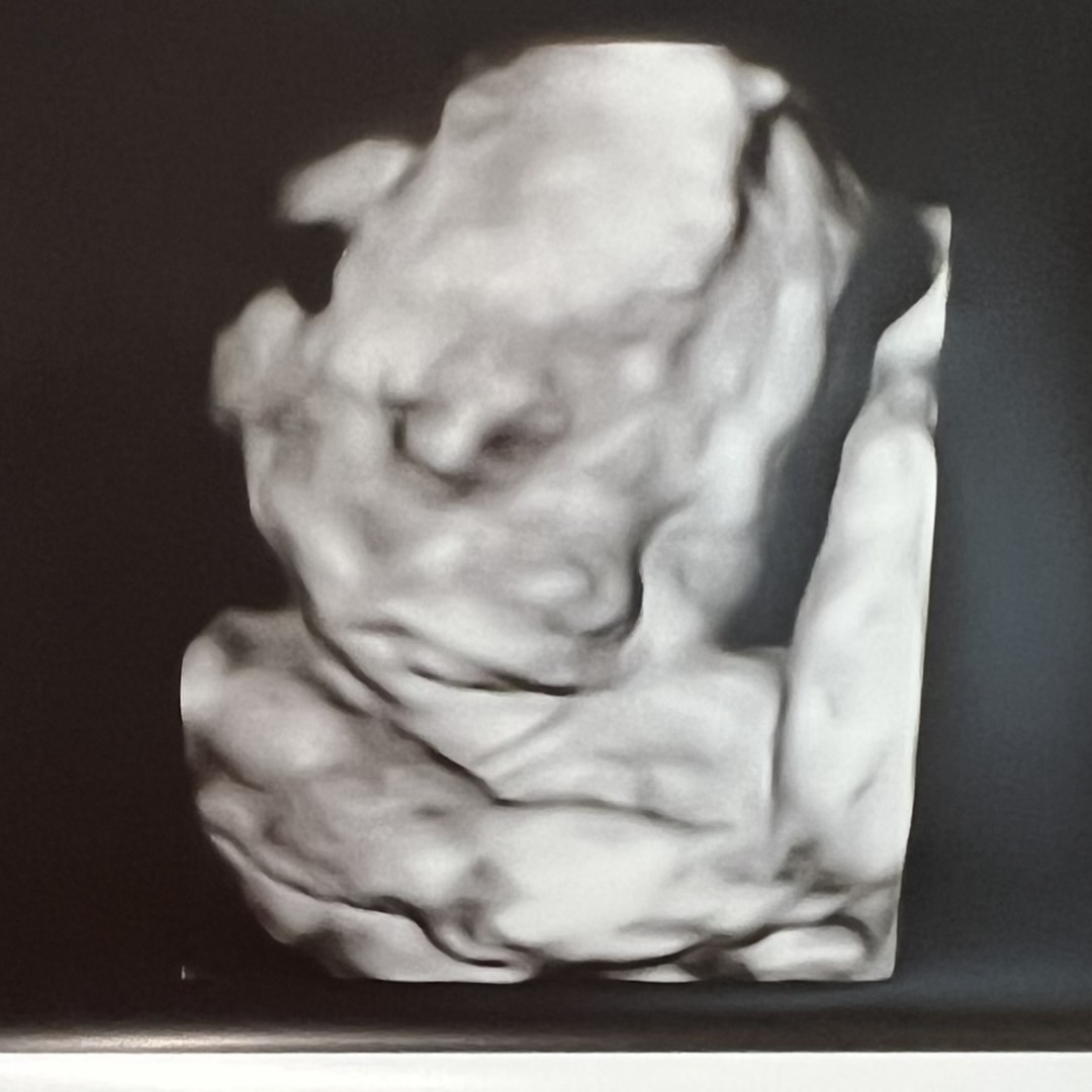 Photo shared by Elena for their Babylist baby registry.