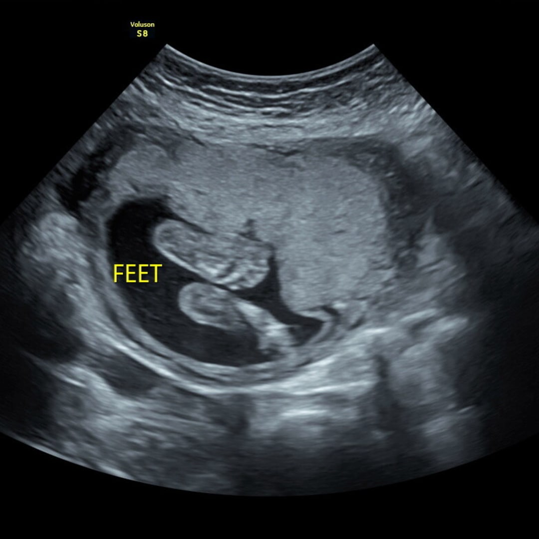 Photo shared by Kennedy for their Babylist baby registry.