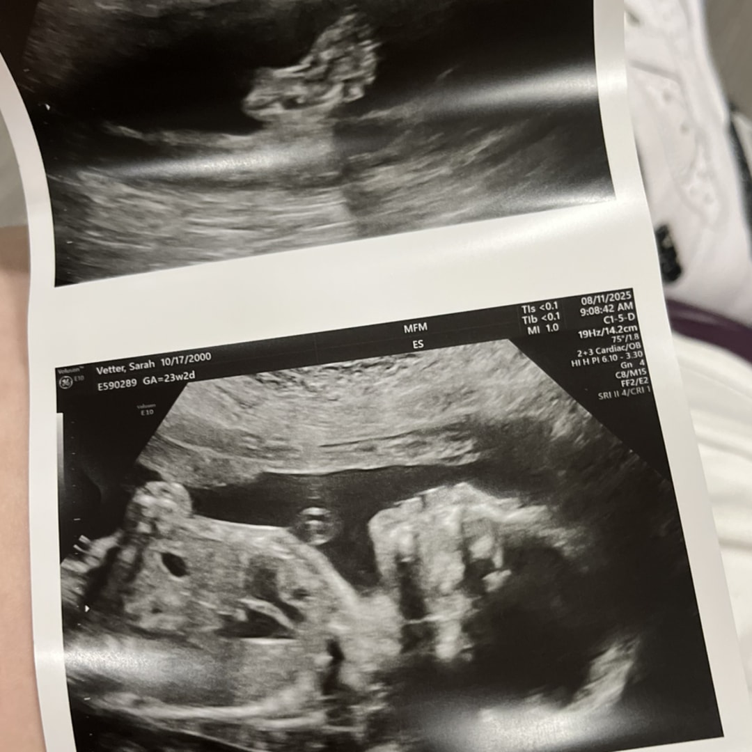 Photo shared by Sarah for their Babylist baby registry.