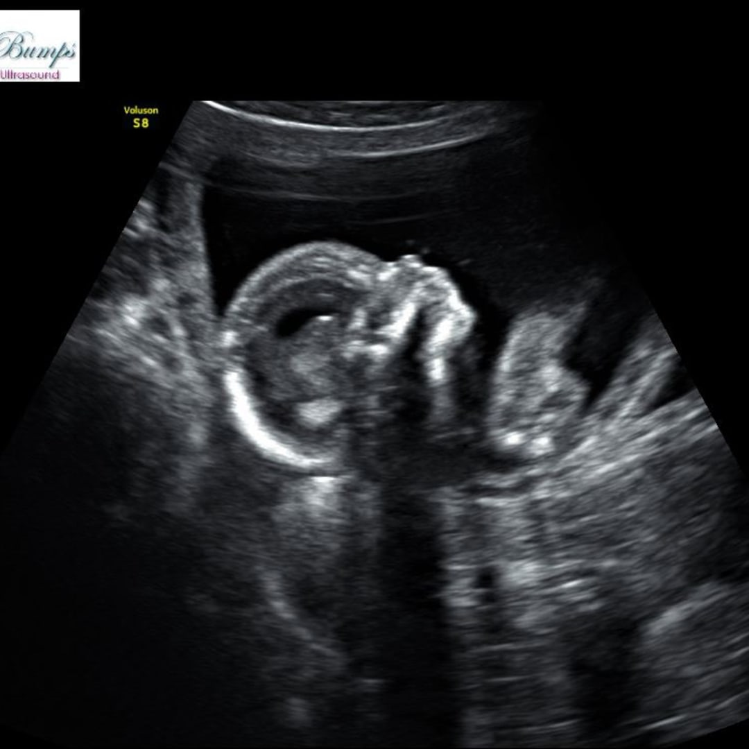 Photo shared by Alycenne for their Babylist baby registry.
