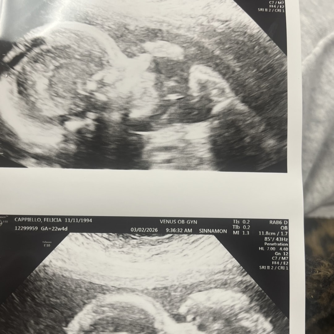 Photo shared by Felicia for their Babylist baby registry.