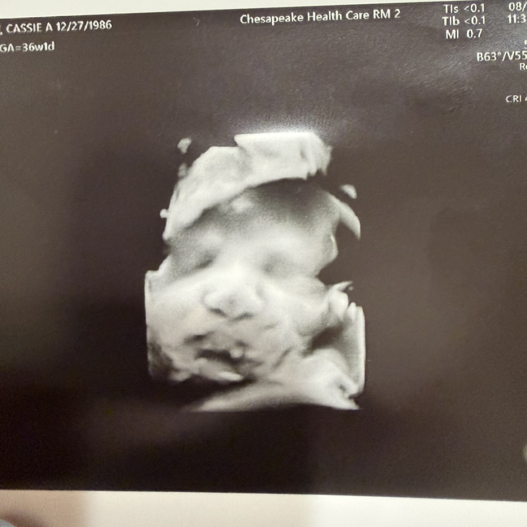 Photo shared by Cassie for their Babylist baby registry.