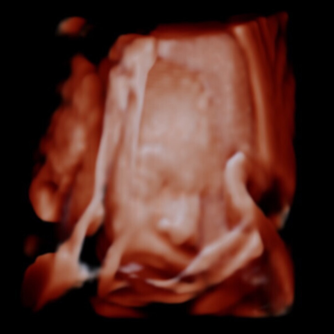 Photo shared by Sadez for their Babylist baby registry.