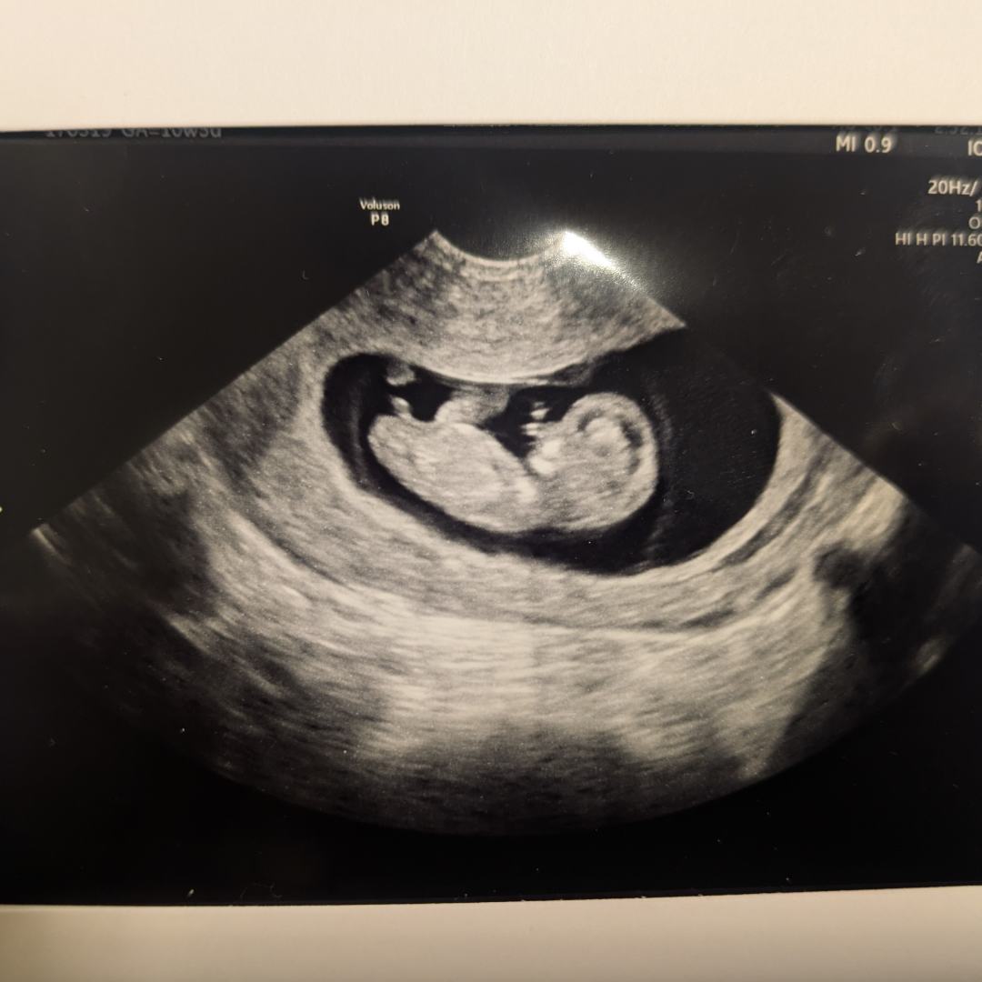 Photo shared by Alexis for their Babylist baby registry.