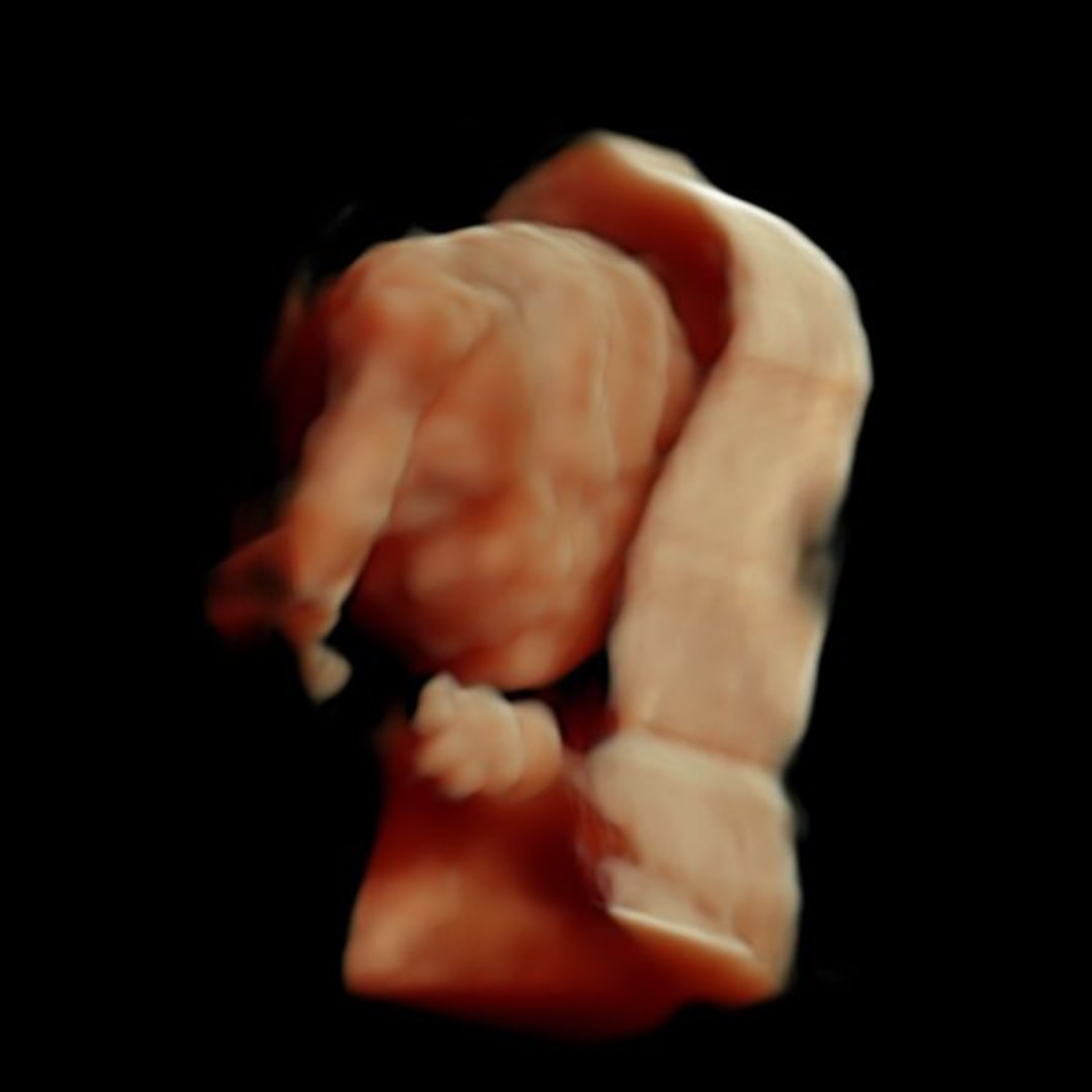 Photo shared by Alyssa for their Babylist baby registry.