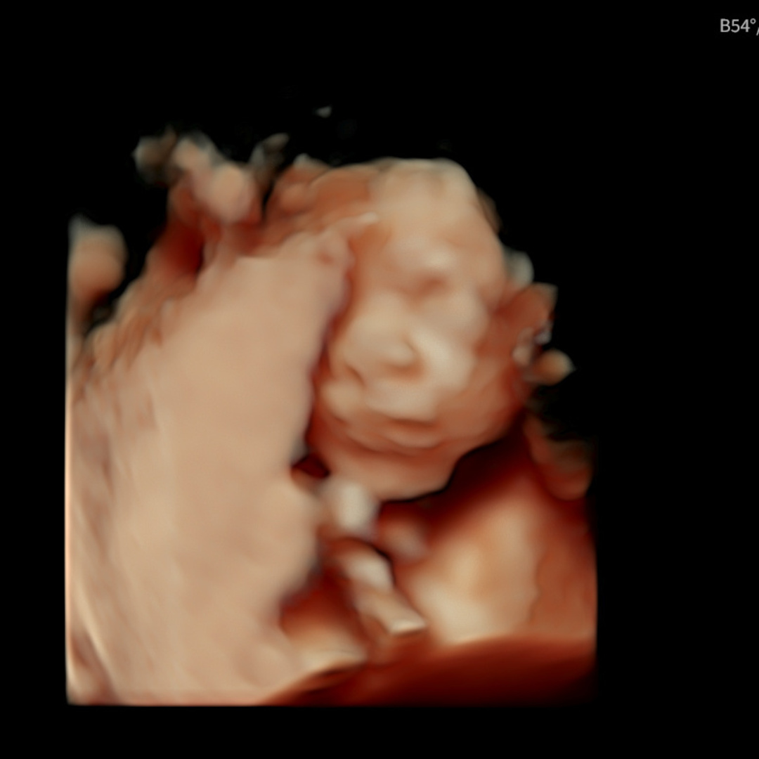 Photo shared by Lyiaih for their Babylist baby registry.