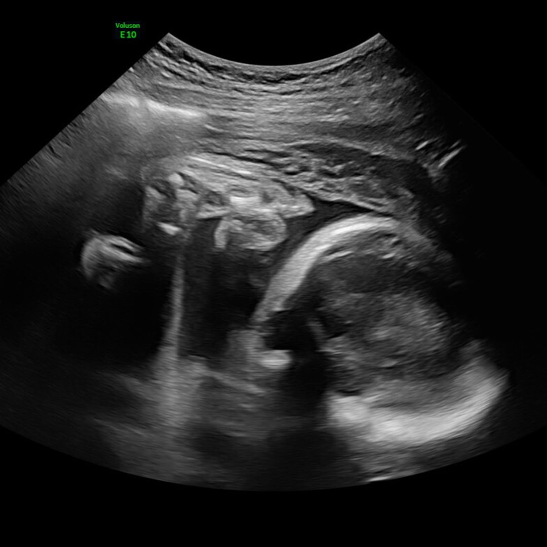 Photo shared by Alyssa for their Babylist baby registry.