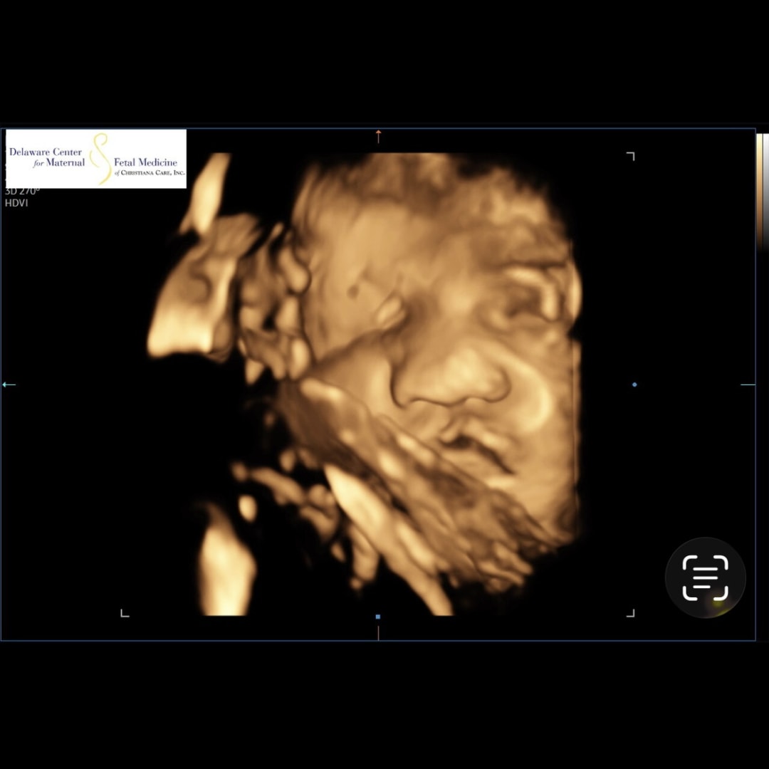 Photo shared by Zhea for their Babylist baby registry.