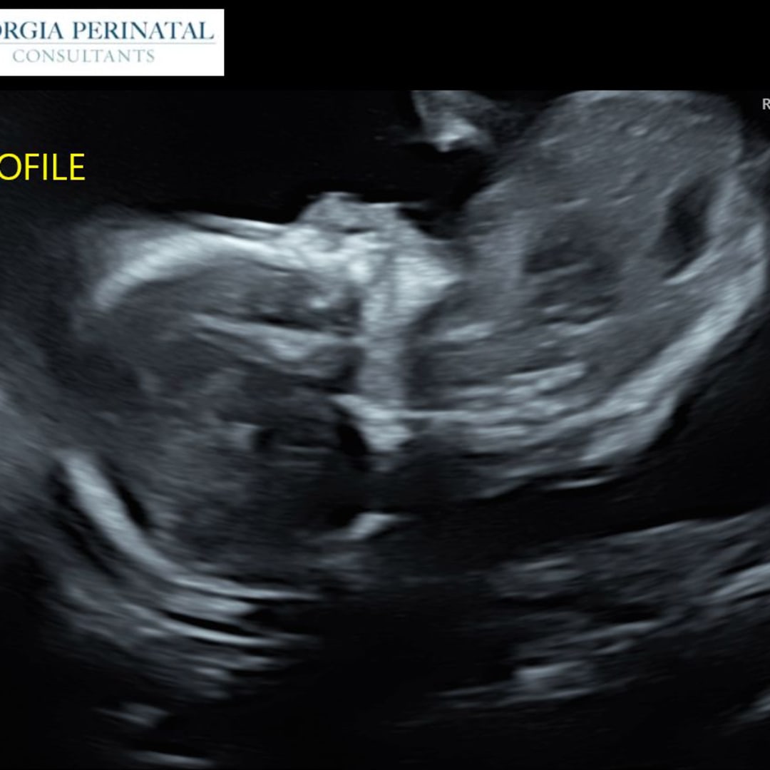 Photo shared by Cassidy for their Babylist baby registry.