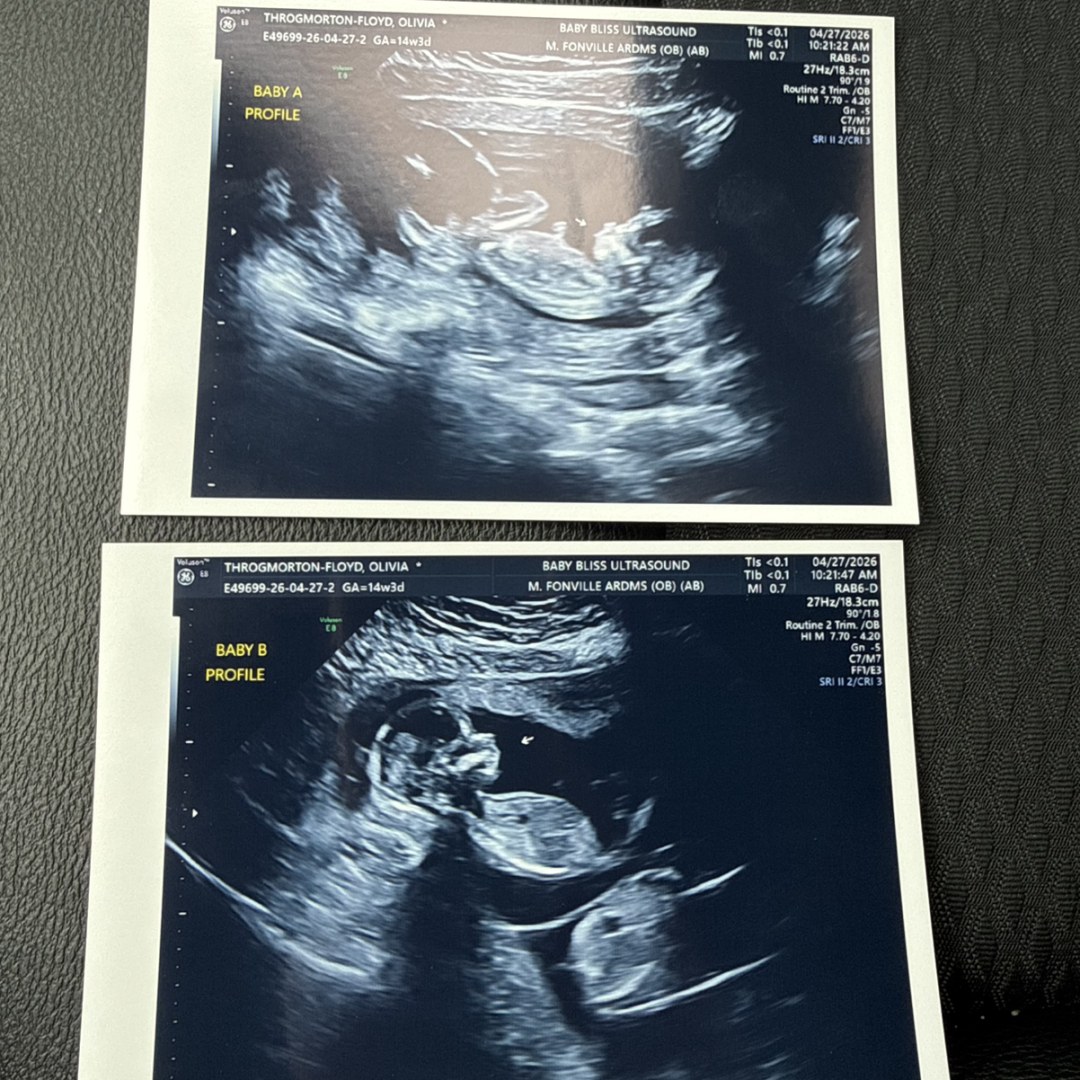 Photo shared by Olivia for their Babylist baby registry.