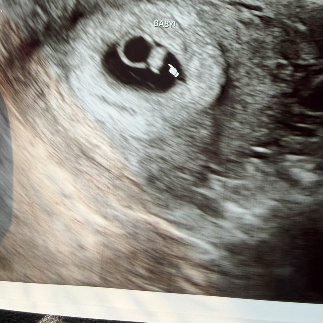 Photo shared by Anna for their Babylist baby registry.