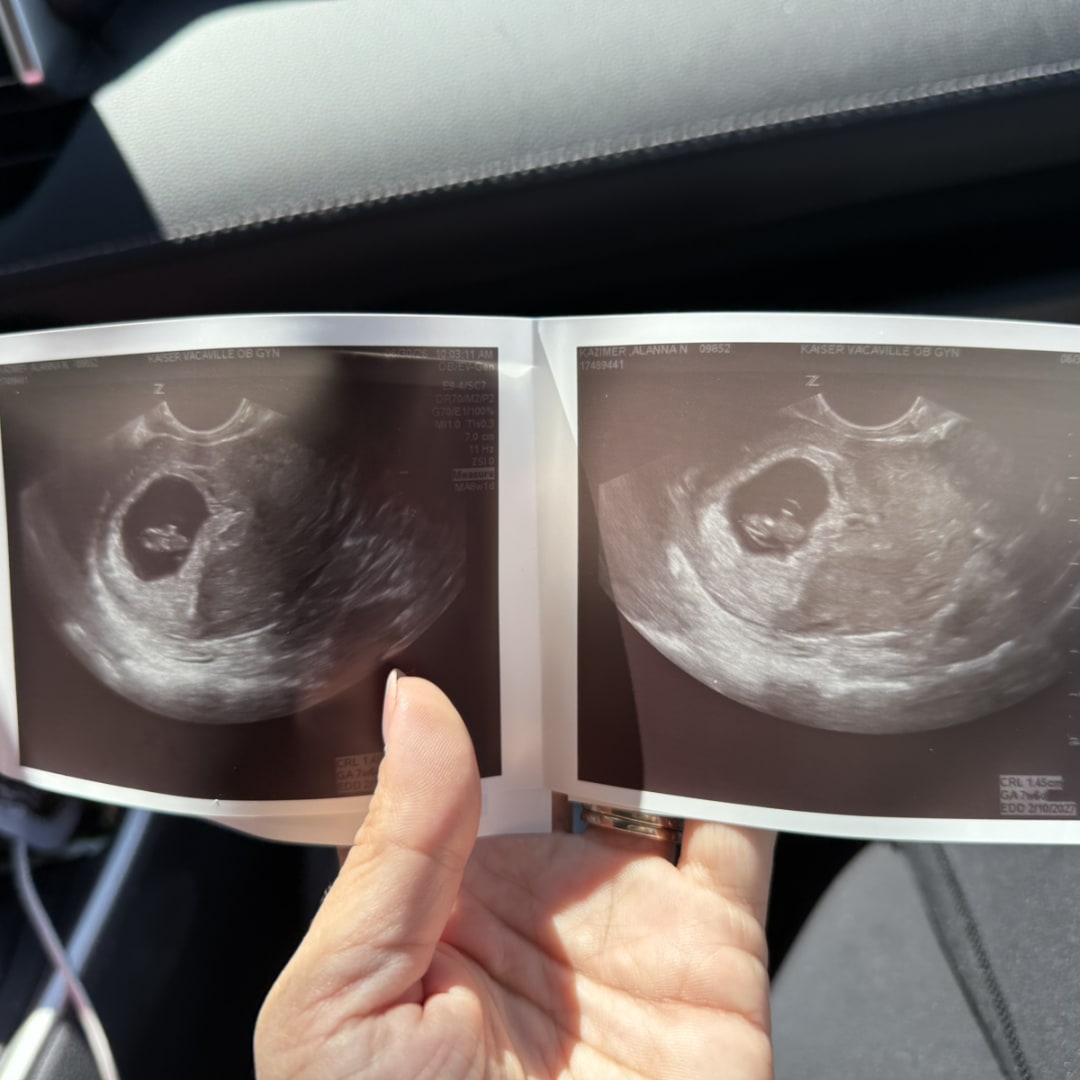 Photo shared by Alanna for their Babylist baby registry.