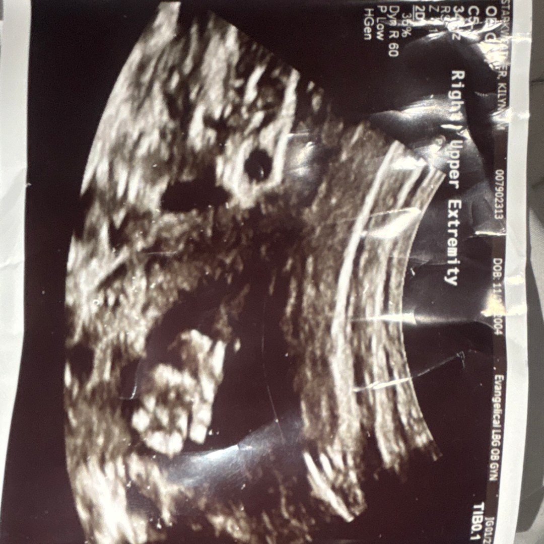 Photo shared by Kilynn for their Babylist baby registry.