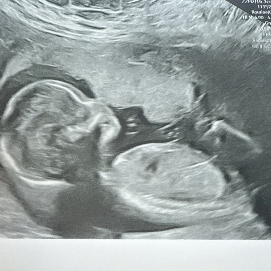 Photo shared by Maryori for their Babylist baby registry.
