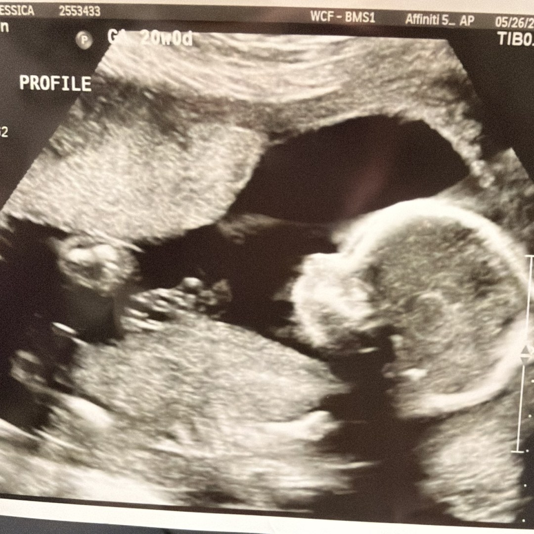 Photo shared by Jessy for their Babylist baby registry.