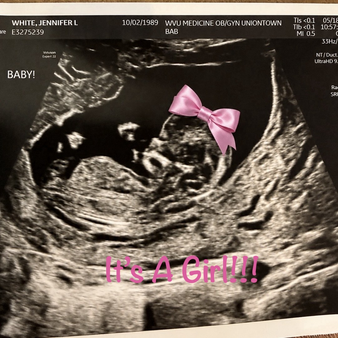 Photo shared by Jennifer for their Babylist baby registry.