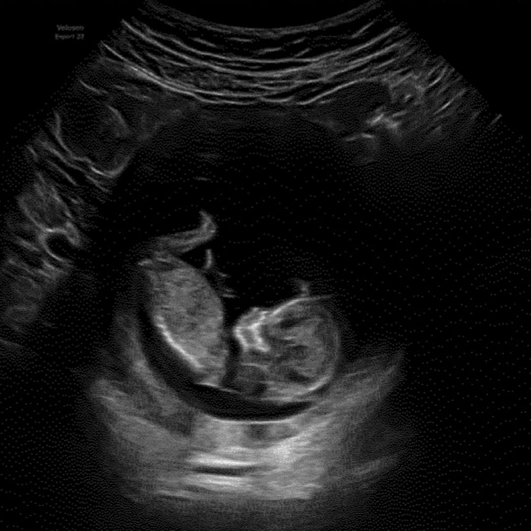 Photo shared by Marcella for their Babylist baby registry.