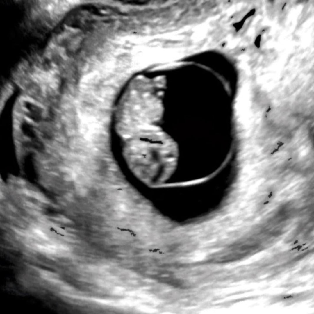 Photo shared by Melany for their Babylist baby registry.