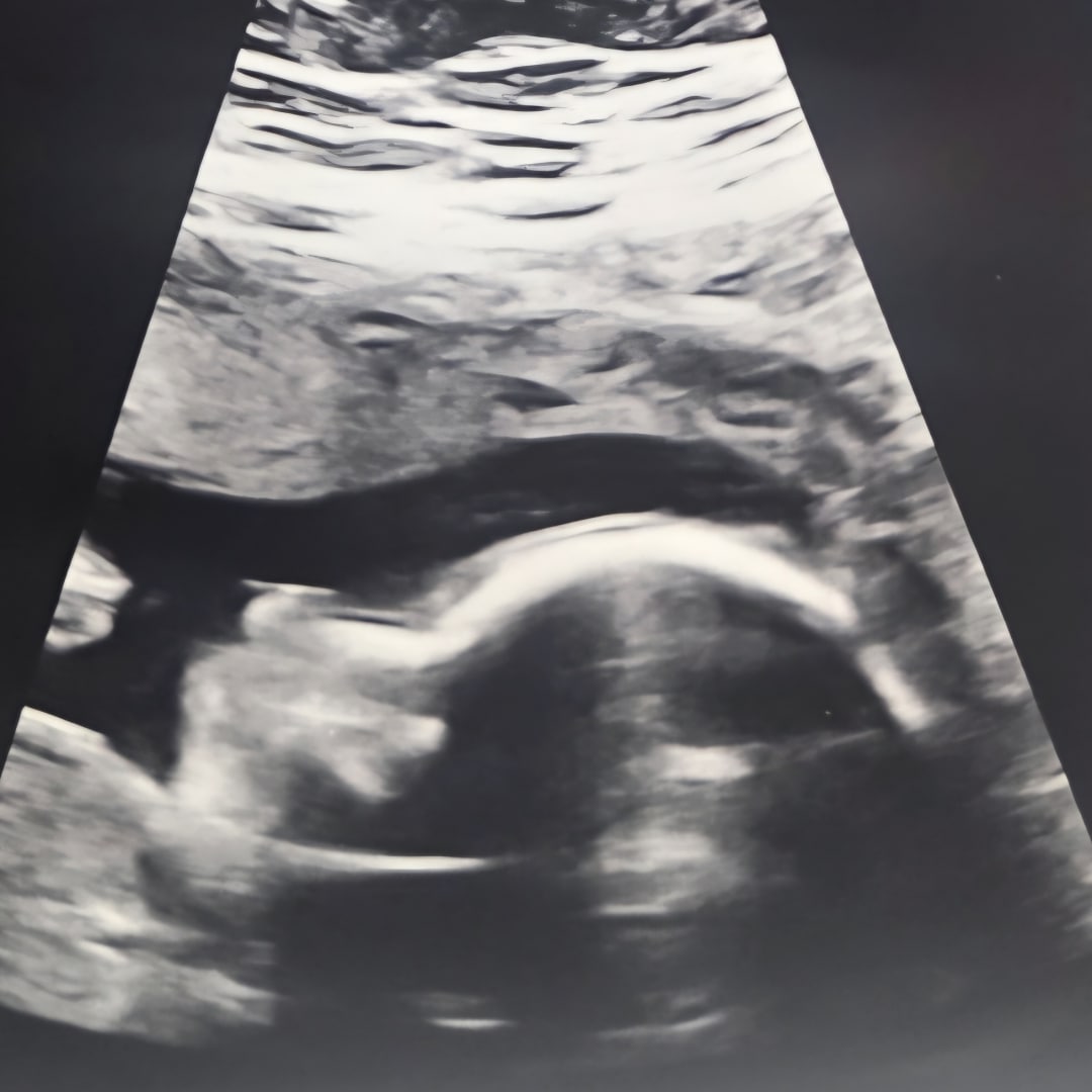 Photo shared by Melissa for their Babylist baby registry.